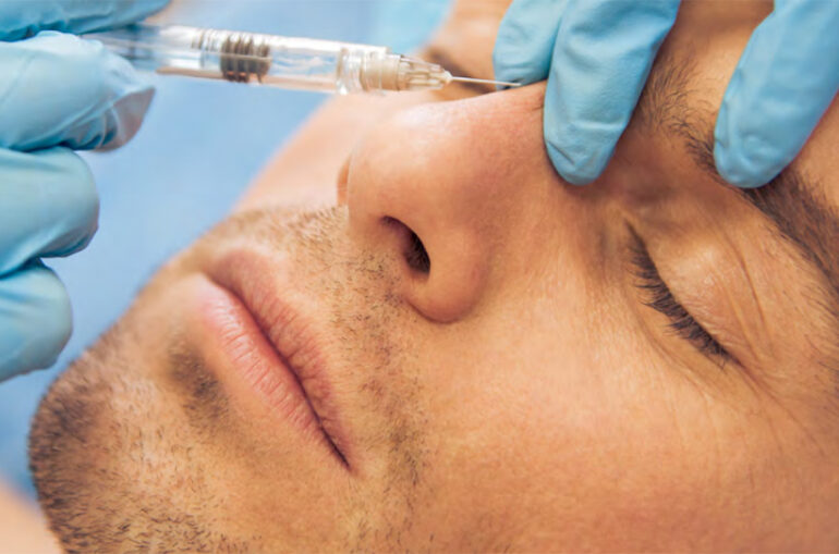 Tratamientos de belleza para hombres Botox