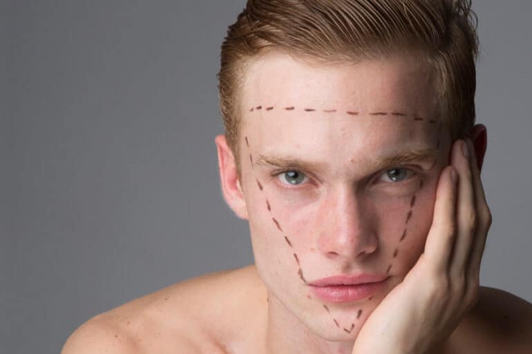 masculinización-facial-tratamientos-antes-y-después