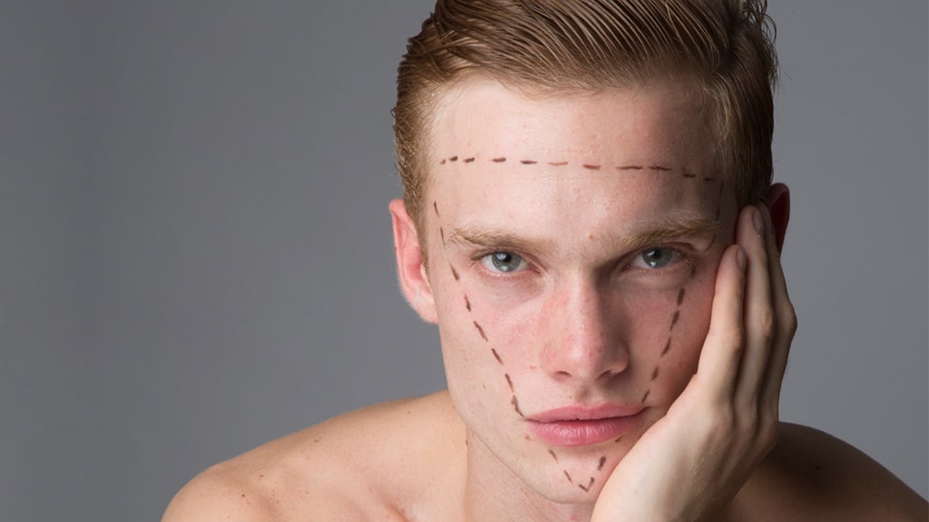 masculinización-facial-tratamientos-antes-y-después