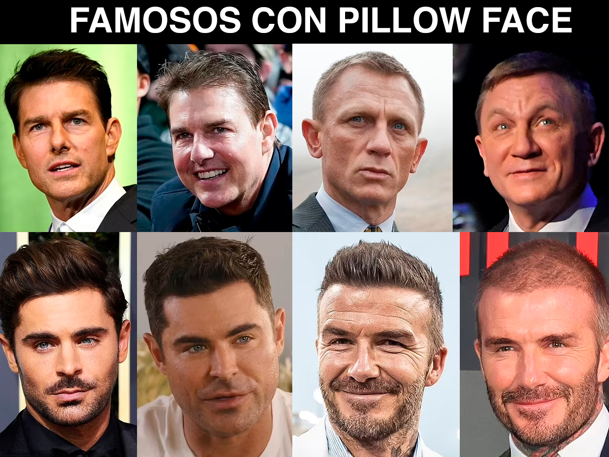 como-eliminar-arrugas-y-lineas-expresion-sin-botox-famosos-pillow-face