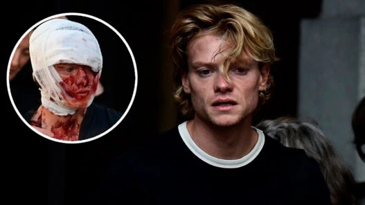 Tom hys Harries primeras imágenes en el rodaje de Clayface