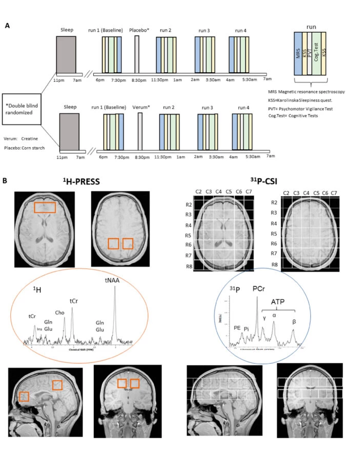 Diseño del estudio sobre creatina y privación de sueño con pruebas cognitivas y resonancia magnética cerebral