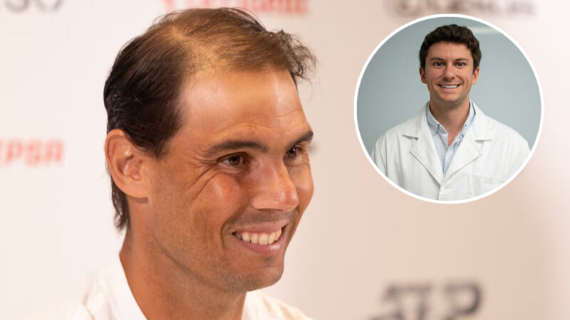 Imagen destacada de un artículo sobre el cuidado del cabello y los transplantes capilares con Rafael Nadal con poco pelo y el dr. Margalejo de la clínica Insparya
