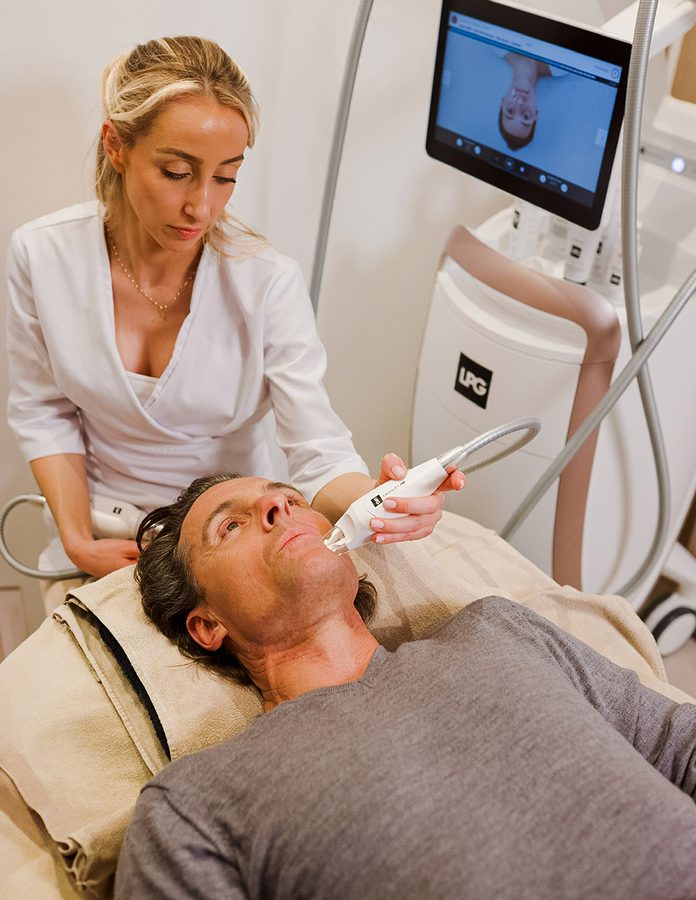 hombre realizándose tratamiento de IPL en el rostro