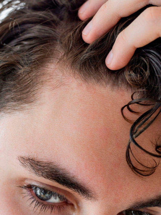 hombre joven mirándose la entrada del cabello